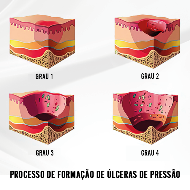 Almofada Anti-Escaras com Espuma de Memória - Viscoelástica